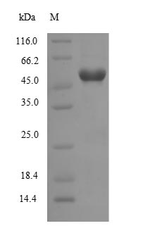 (Tris-Glycine gel) Discontinuous SDS-PAGE (reduced) with 5% enrichment gel and 15% separation gel.